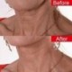 * 2 Chest Anti Wrinkle. Újrahasznosítható ápolás A ránctalanító nyak mellkasát tisztító pad ellen öregedés