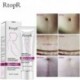 Rtopr Mango Távolítson el terhességi hegeket pattanáskrém-stretch Marks Kezelési Mater I7J4