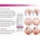 Rtopr Mango Távolítson el terhességi hegeket pattanáskrém-stretch Marks Kezelési Mater I7J4