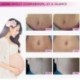 Rtopr Mango Távolítson el terhességi hegeket pattanáskrém-stretch Marks Kezelési Mater I7J4