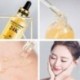 Hanhuo 24K Gold arcszérum hialuronsav szérum hidratáló Essence krém J8X4