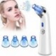 Blackhead Remover pórusos vákuum - arcbőr tisztító elektromos pattanásokkal járó Comedone F3L5