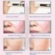 4X (OEDO Rose Peptide tápláló tiszta toner bőrápoló fehérítő hidratáló AH1S4