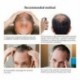 Lanbena gyors teljesítményű hajnövekedési termékek Hajspray esszencia haj elleni Fal E4I6