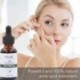 Melao Pure természetes teafa illóolaj ráncok ellen zsugorodó pórus Essence B2C4