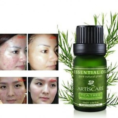 ARTISCARE tiszta teafa illóolaj az arcápoláshoz pattanáskezelő olaj T6K6