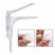 Eldobható hüvelybővítő nemi szervek Anális dilator Colposcopy Speculum Orvosi női higiénia