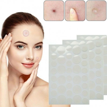 4 * 36PCS - Bőrcímke és pattanás tapasz - ÚJ hidrokolloid pattanások és bőrcímkék eltávolító tapaszok
