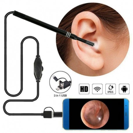 Nincs szín - US PRO HD fülkanál endoszkóp fülzsír tisztító Otoszkóp kamera 1.3MP kamera 3in1