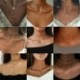 * 100 Arany Rózsa Virág - Divat női többrétegű kristály medál choker gallér lánc nyaklánc ékszerek