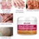 Antibakteriális krém bőr pikkelysömör krém Dermatitis ekcematoid ekcéma kenőcs pikkelysömör bőr kiütés Urticaria