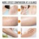 10ml - 50ml tartós, erőteljes szőreltávolító spray-gátló szakáll-bikini intim lábak hónalj fájdalommentes arczavar