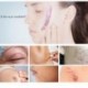 Akne hegeltávolító krém pattanások Stretch Marks arczselés Stretch Remover krémjavító arckrém Bőrápolás Brighten