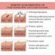Akne hegeltávolító krém pattanások Stretch Marks arczselés Stretch Remover krémjavító arckrém Bőrápolás Brighten