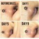 Fehér szín - 20 db Piercing gyógyító szilikon korongok Fix gyűrű a fülbevaló hátuljához Átlátszó lemezpárnák a