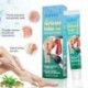 20g Visszér kezelésére Krém Kínai Orvoslás Vasculitis Flebitis Pók fájdalomcsillapító kenőcs Orvosi Gipsz Testápoló