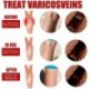 1db 10g Visszér Kezelő Krém Comb Pók eltávolítása Flebitis Vasculitis Kenőcs Duzzanat Fájdalomcsillapító Gipsz