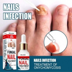 50 ml Nail Repair Essence szérum gombaellenes körömápoló körömgomba eltávolítása tápláló kéz Láb lábujjak