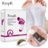 10 pár/doboz RtopR Hagyományos Kínai Orvoslás Méregtelenítő lábtapasz Wormwood Health Body Detox Improve Sleep Foot Care