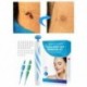Szín: Skin Tag Removal Kit - Fájdalommentes bőrcímke anyajegy szemölcs eltávolító készlet 40x gumiszalag   10x