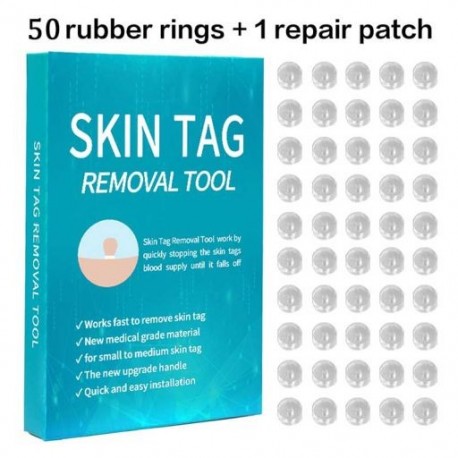 Szín: 50db - Bőrcímke eltávolító készlet kicsitől nagyig (2 mm-től 4 mm-ig) biztonságos bőrcímkék archoz nyak test